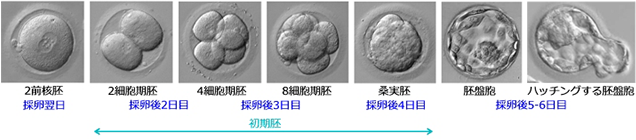 銀座レディースクリニック　採卵から胚／胚盤胞移植までの流れ
