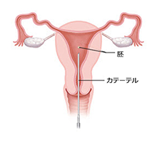 銀座レディースクリニック　採卵から胚／胚盤胞移植までの流れ